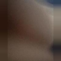 MBT
